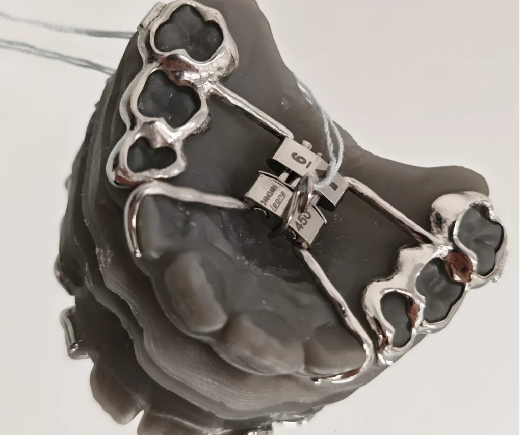 laboratoire dentaire dentotech bethune laboratoire dentaire dentotech bethune Appareils orthodontiques Laboratoire dentaire DENTOTECH à Béthune