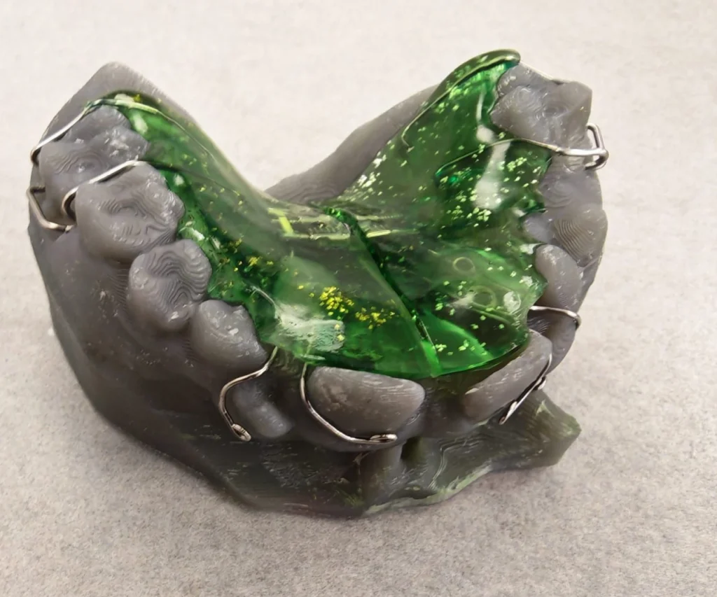 laboratoire dentaire dentotech bethune laboratoire dentaire dentotech bethune Appareils orthodontiques Laboratoire dentaire DENTOTECH à Béthune