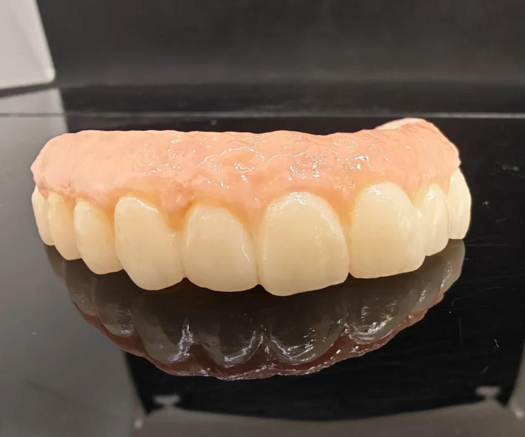 laboratoire dentaire dentotech bethune laboratoire dentaire dentotech bethune Prothèse conjointe Laboratoire dentaire DENTOTECH à Béthune