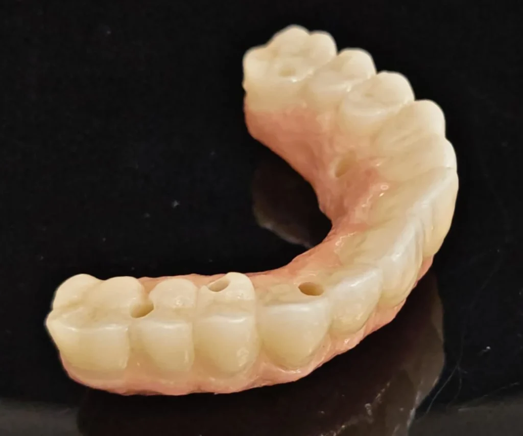 laboratoire dentaire dentotech bethune laboratoire dentaire dentotech bethune Prothèse conjointe Laboratoire dentaire DENTOTECH à Béthune