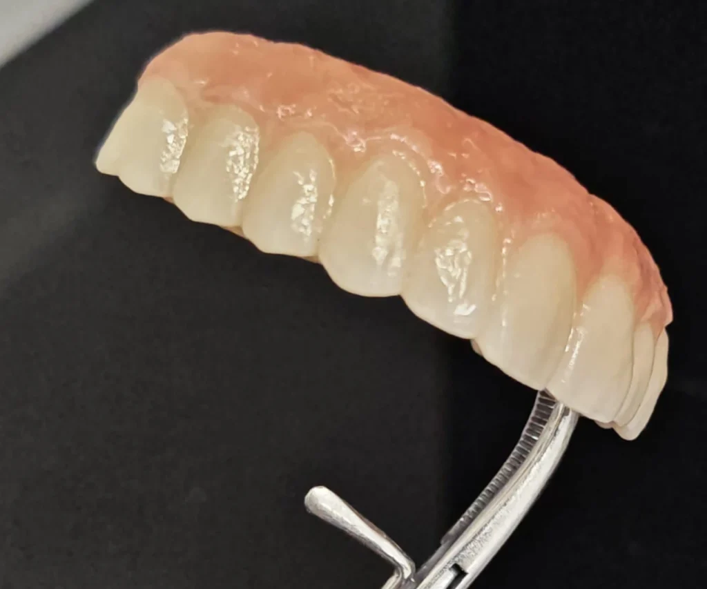 laboratoire dentaire dentotech bethune laboratoire dentaire dentotech bethune Notre métier Laboratoire dentaire DENTOTECH à Béthune