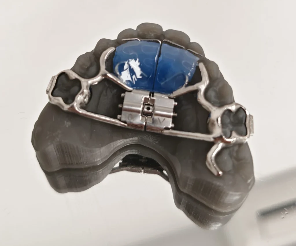 laboratoire dentaire dentotech bethune laboratoire dentaire dentotech bethune Notre métier Laboratoire dentaire DENTOTECH à Béthune