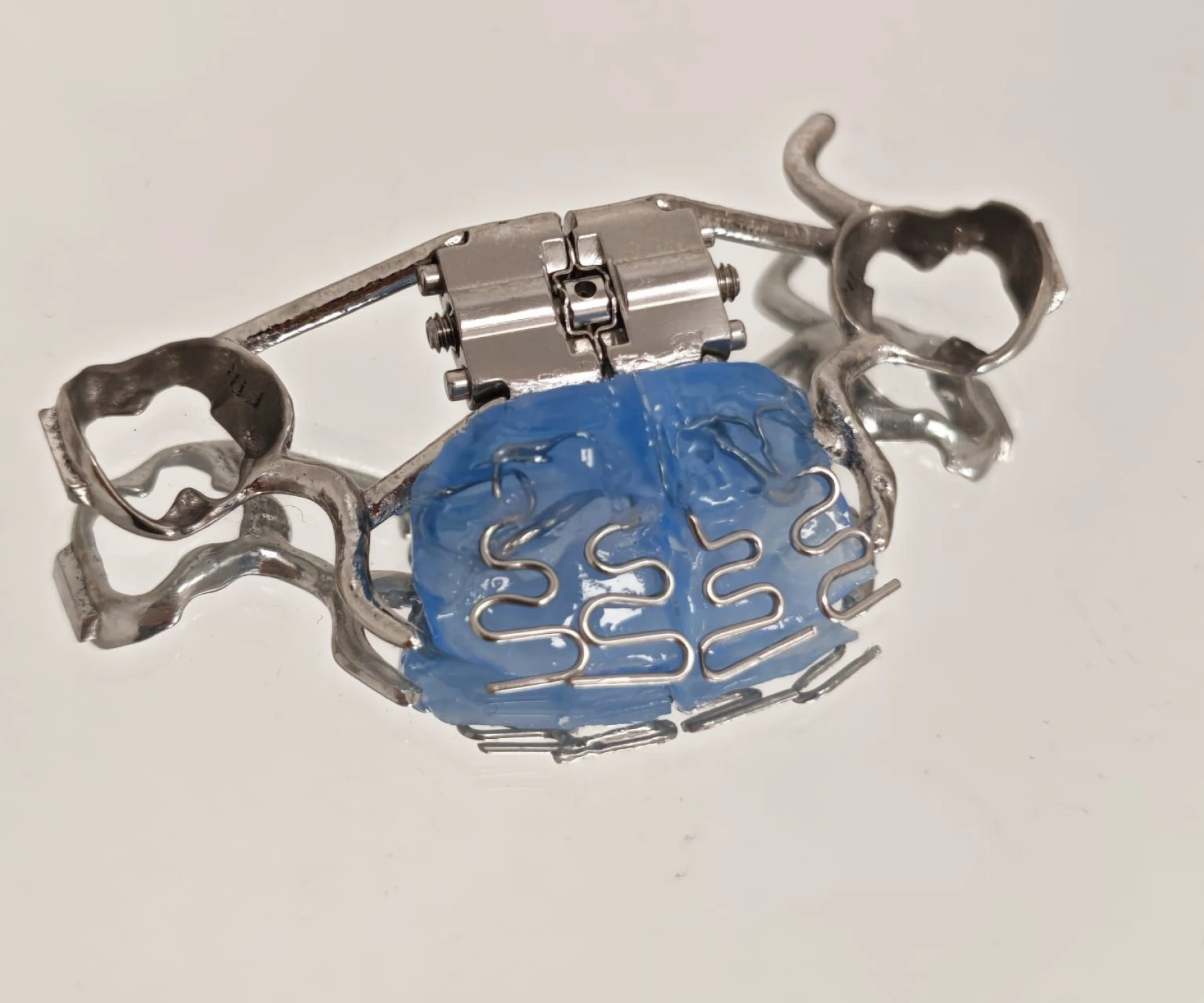 laboratoire dentaire dentotech bethune Prothèse adjointe Laboratoire dentaire DENTOTECH à Béthune