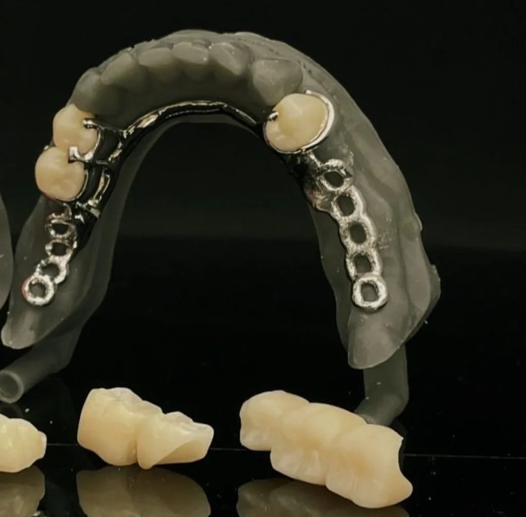 protheses adjointe amovibles dentotech bethune protheses adjointe amovibles dentotech bethune Prothèse adjointe Laboratoire dentaire DENTOTECH à Béthune