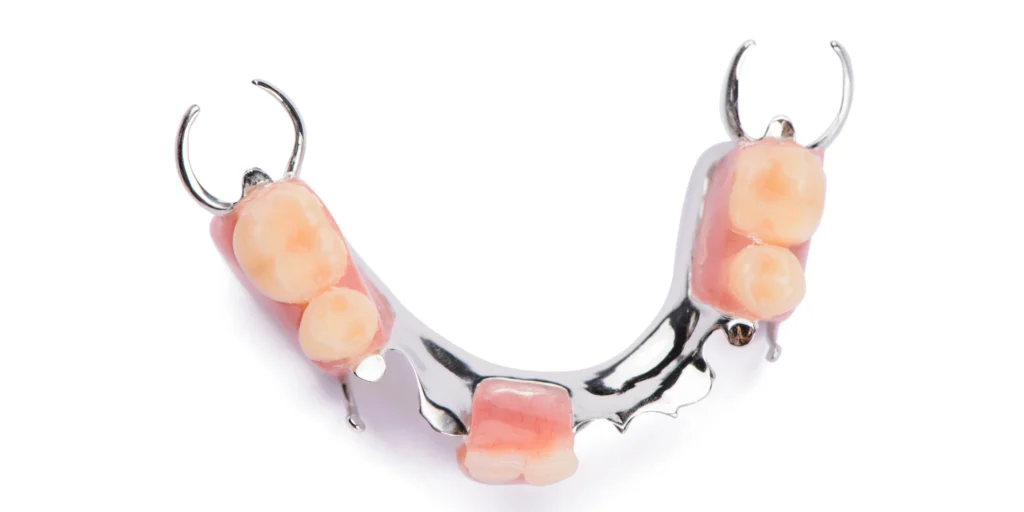 protheses adjointe dentotech bethune protheses adjointe dentotech bethune Prothèse adjointe Laboratoire dentaire DENTOTECH à Béthune