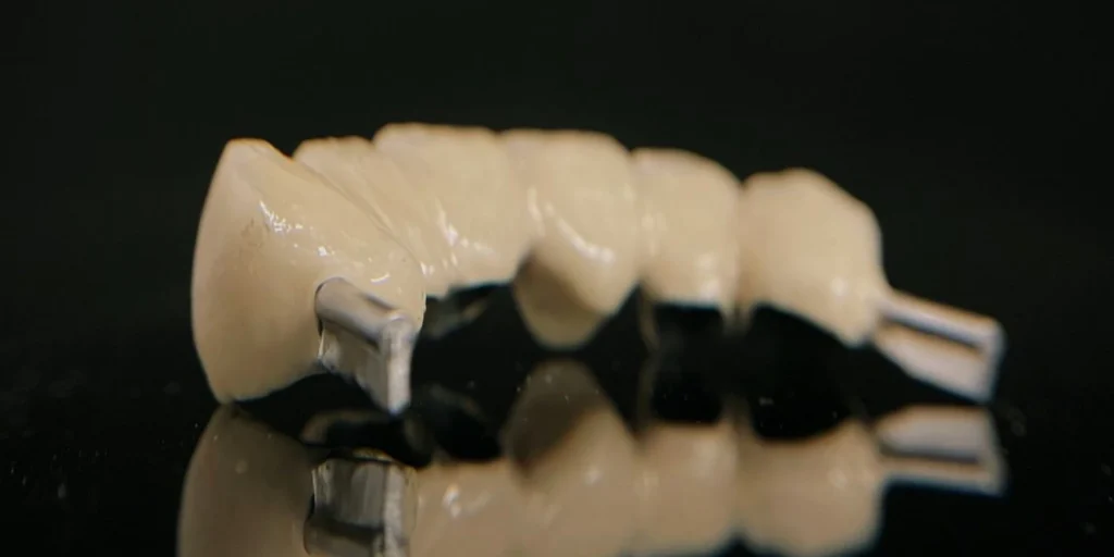 protheses adjointes amovibles dentotech bethune protheses adjointes amovibles dentotech bethune Prothèse conjointe Laboratoire dentaire DENTOTECH à Béthune