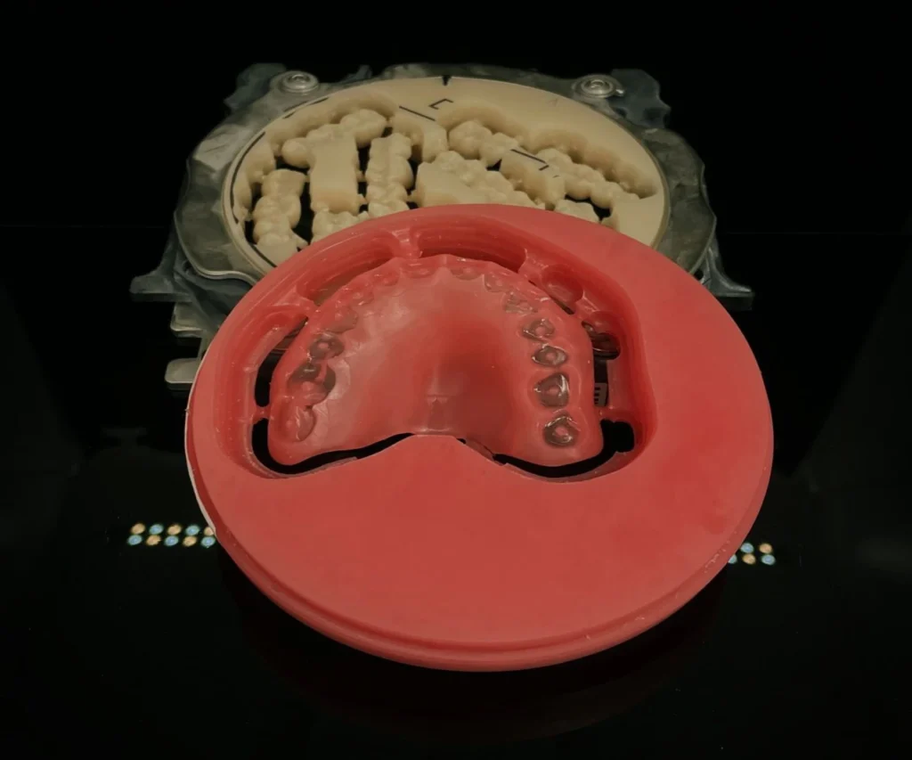 protheses conjointes fixes dentotech bethune protheses conjointes fixes dentotech bethune Prothèse conjointe Laboratoire dentaire DENTOTECH à Béthune